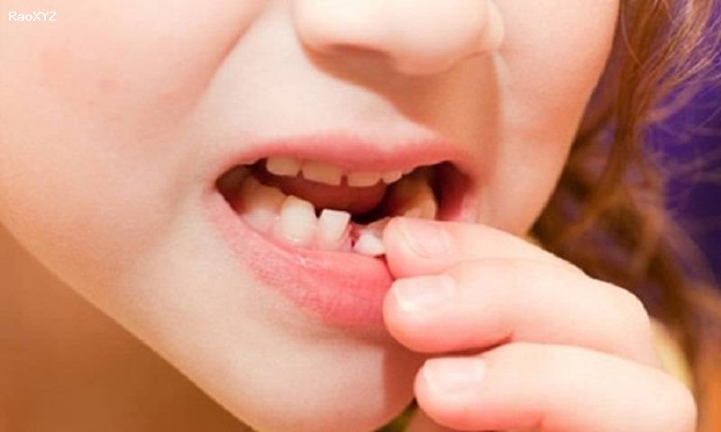 Nhổ răng sữa cho bé an toàn