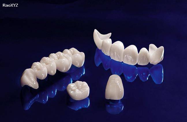 dịch vụ bọc răng sứ Zirconia chất lượng