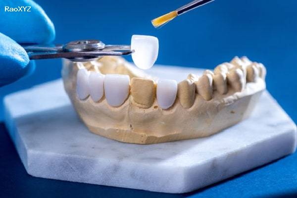 Bọc răng sứ thẩm mỹ có những lợi ích gì?
