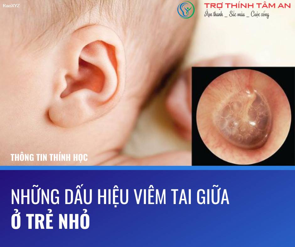 Những dấu hiệu viêm tai giữa ở trẻ nhỏ